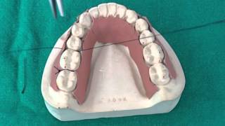 Peridontal Suturing Techniques [upl. by Dranreb]