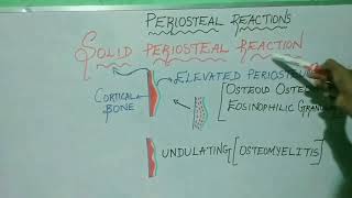 PERIOSTEAL BONE REACTIONS [upl. by Anirtep]