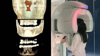 Cone Beam CT and 3D imaging [upl. by Wootan226]