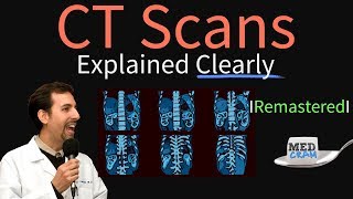 High Resolution CT Scan HRCT Explained Clearly  Remastered [upl. by Dalohcin]