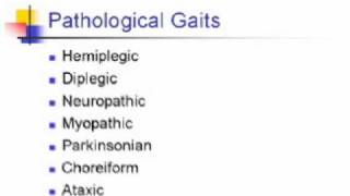 Gait Examination Anatomy  Localizing Value [upl. by Assirem]