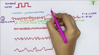 Electroencephalogram EEG  Waves  Physiology [upl. by Klotz]