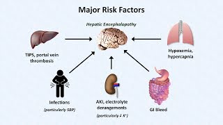 Hepatic Encephalopathy [upl. by Saxe44]